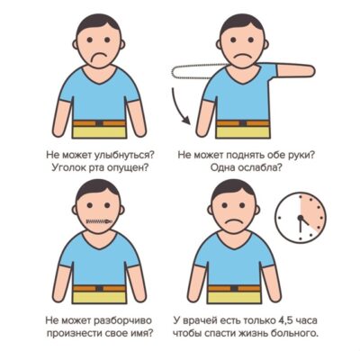 Как распознать инсульт