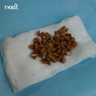 Напоминание о важности заботы о здоровье почек